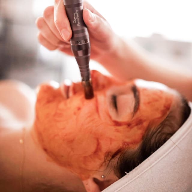 Facial Infusion Package at Clear Beauty Aesthetics in Richardson, TX